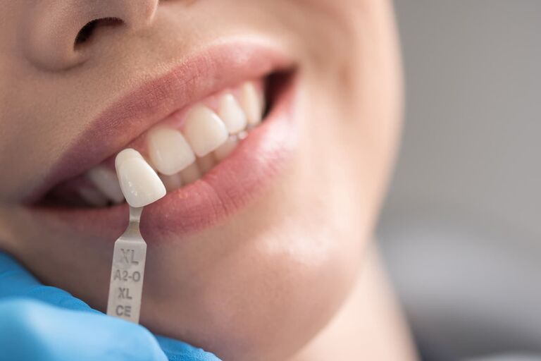 RHOS Dental Practice Dental Treatments in Rhos, Wrexham